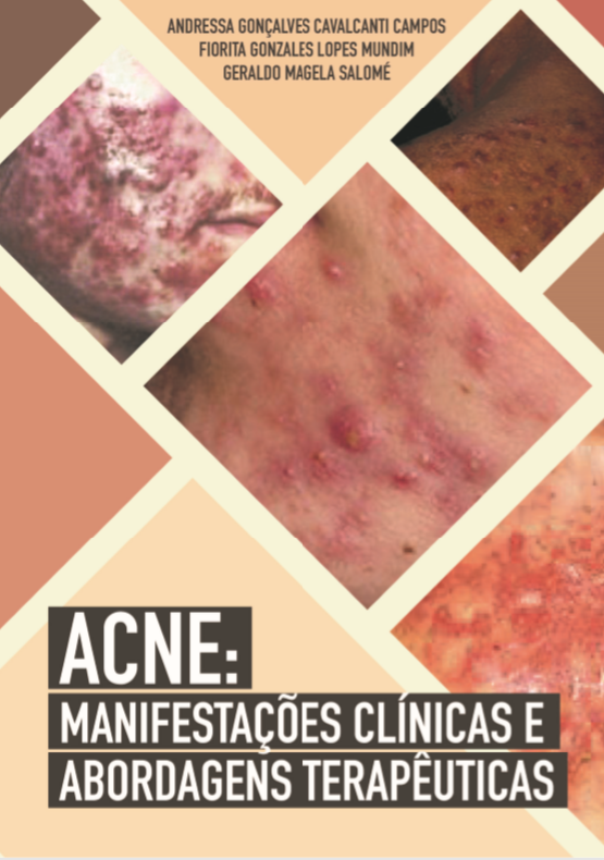 Publicao Acne